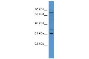 WB Suggested Anti-Fbxo34 Antibody Titration: 0. (FBXO34 Antikörper  (N-Term))