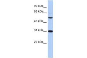 Western Blotting (WB) image for anti-Peptidase Inhibitor 16 (PI16) antibody (ABIN2463939) (PI16 Antikörper)