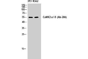Western Blotting (WB) image for anti-CaMKIIalpha/delta (Thr286) antibody (ABIN5960662) (CaMKIIalpha/delta Antikörper  (Thr286))