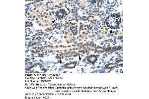 Human kidney (Serotonin Receptor 3A Antikörper  (N-Term))