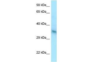 WB Suggested Anti-YIPF1 Antibody Titration: 1. (YIPF1 Antikörper  (C-Term))