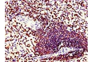 Immunohistochemistry of paraffin-embedded human spleen tissue using ABIN7148593 at dilution of 1:100 (Coronin 1a Antikörper  (AA 363-432))