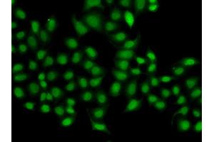 Immunofluorescence analysis of A549 cell using SULT2B1 antibody. (SULT2B1 Antikörper)