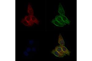 ABIN6264139 and ABIN6277592 staining Hela cells by IF/ICC.