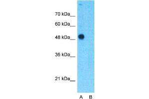 Host:  Rabbit  Target Name:  TEAD4  Sample Type:  293T  Lane A:  Primary Antibody  Lane B:  Primary Antibody + Blocking Peptide  Primary Antibody Concentration:  1ug/ml  Peptide Concentration:  5ug/ml  Lysate Quantity:  25ug/lane/lane  Gel Concentration:  0. (TEAD4 Antikörper  (C-Term))