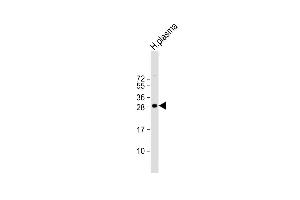Anti-C1QB Antibody (N-term) at 1:1000 dilution + human plasma lysate Lysates/proteins at 20 μg per lane.