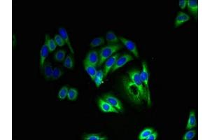 Immunofluorescent analysis of HepG2 cells using ABIN7163920 at dilution of 1:100 and Alexa Fluor 488-congugated AffiniPure Goat Anti-Rabbit IgG(H+L) (KCNK13 Antikörper  (AA 292-408))