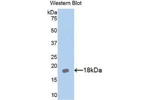 Western blot analysis of the recombinant protein. (IL18RAP Antikörper  (AA 396-548))