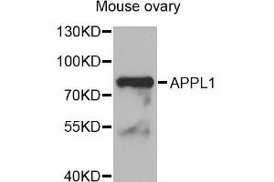 Western Blotting (WB) image for anti-Adaptor Protein, phosphotyrosine Interaction, PH Domain and Leucine Zipper Containing 1 (APPL1) (AA 1-210) antibody (ABIN6220712) (APPL1 Antikörper  (AA 1-210))