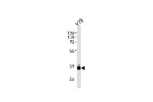 OTX2 Antibody (C-term) (ABIN1881611 and ABIN2845106) western blot analysis in Y79 cell line lysates (35 μg/lane). (OTX2 Antikörper  (C-Term))