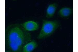 anti-serpin Peptidase Inhibitor, Clade A (Alpha-1 Antiproteinase, Antitrypsin), Member 10 (SERPINA10) (AA 278-425) antibody