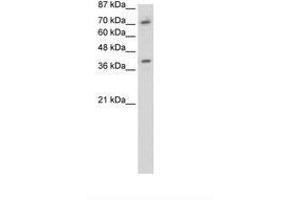 ZNF282 Antikörper  (C-Term)