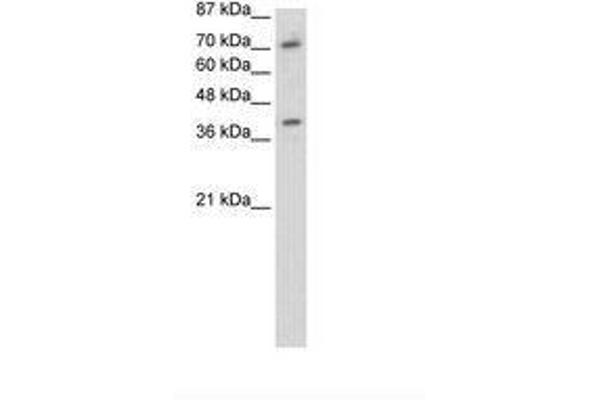 ZNF282 Antikörper  (C-Term)