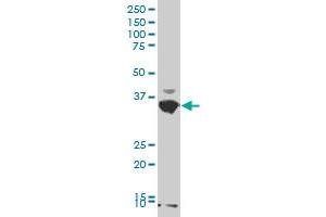 AKR1C2 polyclonal antibody (A01), Lot # CIL0060112QCS1 Western Blot analysis of AKR1C2 expression in HeLa . (AKR1C2 Antikörper  (AA 224-323))