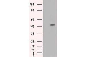 Western Blotting (WB) image for anti-Intraflagellar Transport 57 Homolog (IFT57) antibody (ABIN1498811) (IFT57 Antikörper)