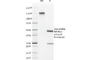 SDS-PAGE Analysis Purified CD1a Mouse Monoclonal Antibody (O10). (CD1a Antikörper)