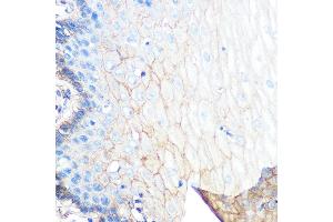 Immunohistochemistry of paraffin-embedded human esophageal using S100 Rabbit mAb (ABIN7270122) at dilution of 1:100 (40x lens). (S100A10 Antikörper)