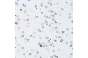 Immunohistochemistry of paraffin-embedded rat brain using TriMethyl-Histone H3-K64 antibody (ABIN7267701) at dilution of 1:100 (40x lens).