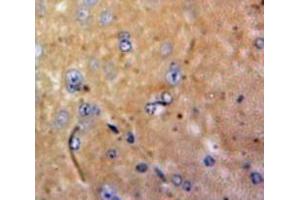 Used in DAB staining on fromalin fixed paraffin-embedded Brain tissue (M-CSF/CSF1 Antikörper  (AA 33-204))