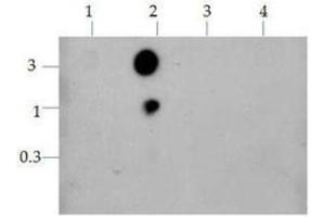 Dot Blot (DB) image for anti-Histone 3 (H3) (H3K14ac), (H3K9ac) antibody (ABIN5706782)