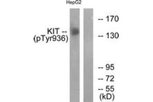 Western blot analysis of extracts from HepG2 cells treated with EGF 200ng/ml 30', using KIT (Phospho-Tyr936) Antibody. (KIT Antikörper  (pTyr936))