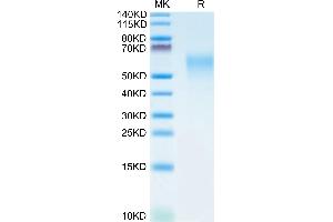 CRTAM Protein (AA 18-287) (His tag)