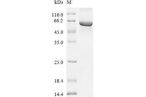 Fyn-Related Kinase (FRK) (AA 1-505), (full length) protein (His tag)