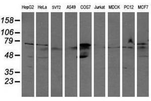 Image no. 2 for anti-Aldehyde Dehydrogenase 3 Family, Member A2 (ALDH3A2) antibody (ABIN1496594) (ALDH3A2 Antikörper)