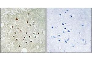 Immunohistochemistry analysis of paraffin-embedded human brain tissue, using RPS19BP1 Antibody. (RPS19BP1 Antikörper  (AA 71-120))