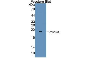Western blot analysis of the recombinant protein. (WTAP Antikörper  (AA 1-150))