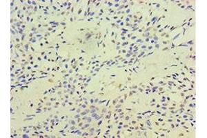 Immunohistochemistry (IHC) image for anti-Telomeric Repeat Binding Factor 2, Interacting Protein (TERF2IP) (AA 1-280) antibody (ABIN7171737)