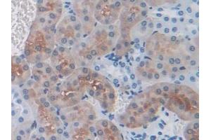 Immunohistochemistry (IHC) image for anti-Thrombospondin 1 (THBS1) (AA 515-671) antibody (ABIN7438112)