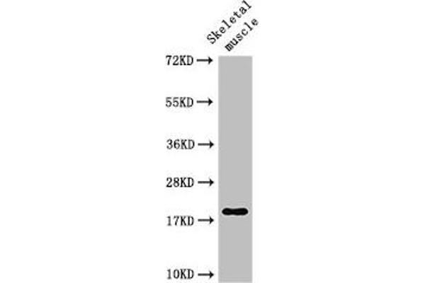 TNNC1 Antikörper  (AA 11-149)