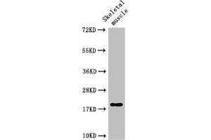 Western Blot Positive WB detected in: Rat skeletal muscle tissue All lanes: TNNC1 antibody at 3 μg/mL Secondary Goat polyclonal to rabbit IgG at 1/50000 dilution Predicted band size: 19 kDa Observed band size: 19 kDa (TNNC1 Antikörper  (AA 11-149))