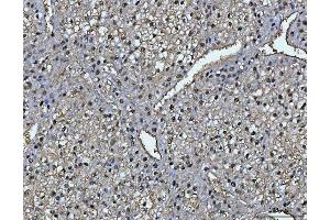 IHC analysis of FAA/FAH using anti-FAA/FAH antibody (ABIN7599291).