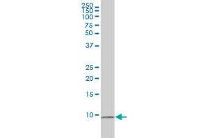 RPS27A monoclonal antibody (M01), clone 3E2-E6 Western Blot analysis of RPS27A expression in HL-60 . (RPS27A Antikörper  (AA 1-156))