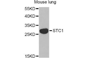 Western blot analysis of extracts of mouse lung, using STC1 Antibody. (Stanniocalcin 1 Antikörper)
