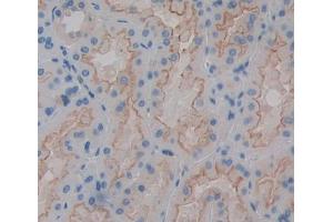 Immunohistochemistry (IHC) image for anti-ATP-Binding Cassette, Sub-Family D (Ald), Member 4 (ABCD4) (AA 356-606) antibody (ABIN5013197)