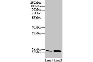 Western blot All lanes: MMGT1 antibody at 12 μg/mL Lane 1: Hela whole cell lysate Lane 2: 293T whole cell lysate Secondary Goat polyclonal to rabbit IgG at 1/10000 dilution Predicted band size: 15, 22 kDa Observed band size: 15 kDa (MMGT1 Antikörper  (AA 66-131))