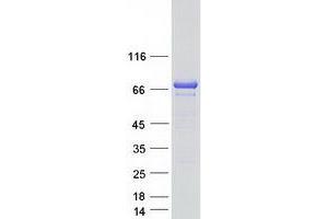 Western Blotting (WB) image for Dystrophia Myotonica-Protein Kinase (DMPK) (Transcript Variant 4) protein (Myc-DYKDDDDK Tag) (ABIN2719535)