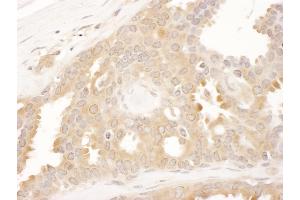 anti-Chaperonin Containing TCP1, Subunit 8 (Theta) (CCT8) (AA 448-498) antibody