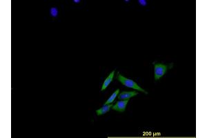Immunofluorescence of monoclonal antibody to ENG on HeLa cell . (Endoglin Antikörper  (AA 27-658))