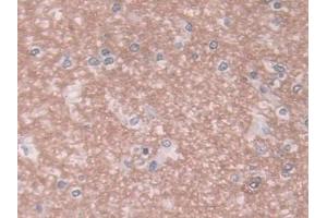 DAB staining on IHC-P; Samples: Human Cerebrum Tissue