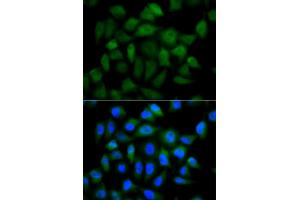 Immunofluorescence analysis of HeLa cells using AFP antibody (ABIN5970034). (alpha Fetoprotein Antikörper  (C-Term))