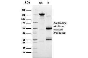 SDS-PAGE (SDS) image for anti-SERPINE1 mRNA Binding Protein 1 (SERBP1) (AA 3-139) antibody (ABIN6939486)