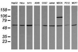 Image no. 3 for anti-Tripartite Motif Containing 38 (TRIM38) (AA 1-265) antibody (ABIN1490679) (TRIM38 Antikörper  (AA 1-265))