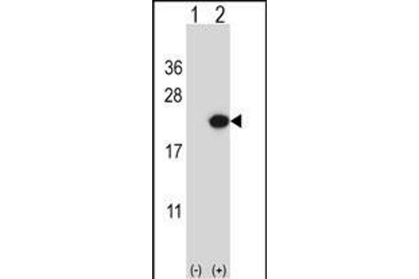 Endothelin 2 antibody  (C-Term)