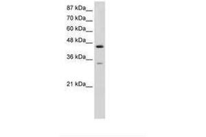 Image no. 1 for anti-Splicing Factor 3b, Subunit 4, 49kDa (SF3B4) (AA 151-200) antibody (ABIN6736239) (SF3B4 Antikörper  (AA 151-200))