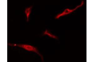 ABIN6274765 staining HeLa cells by IF/ICC. (RPL10A Antikörper  (C-Term))