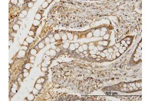 Image no. 1 for anti-N-Myc (And STAT) Interactor (NMI) (AA 1-101) antibody (ABIN598596) (NMI Antikörper  (AA 1-101))